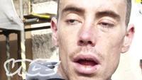 Teenage Heroin Epidemic