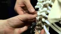 Prehistoric Autopsy: Lucy