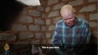 The Spell of the Albino