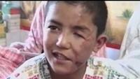 Afghanistan - collateral damage